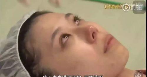 下颌骨缩明星,美丽蜕变背后的秘密